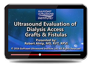 Gulfcoast Ultrasound Evaluation of Dialysis Access Grafts & Fistula